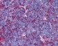 MAP3K7 / TAK1 Antibody (N-Terminus)